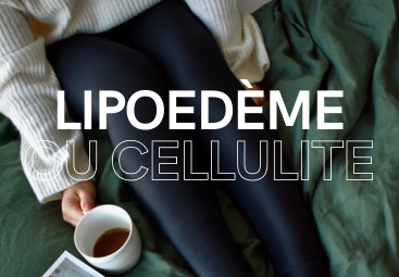 Lipoedème ou cellulite : différences & symptômes