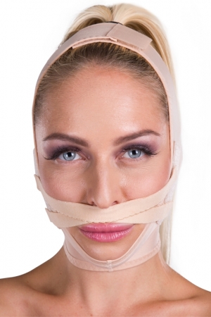 FM lip lift